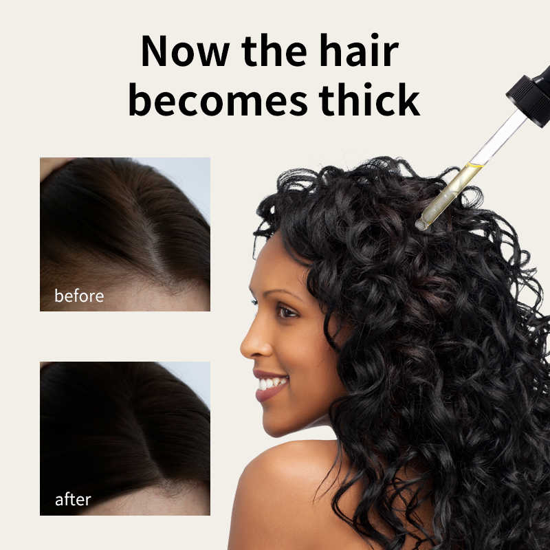 Minyak Penumbuh Rambut Syulli | Minyak Anti Rambut Rontok Rosemary & Jahe | Merangsang Folikel