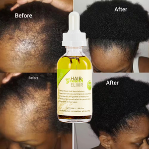 Ramuan Penumbuh Rambut Herbal dengan Rosemary & Peppermint | 8 Ekstrak Tumbuhan | Perawatan Kulit Kepala | OEM/ODM