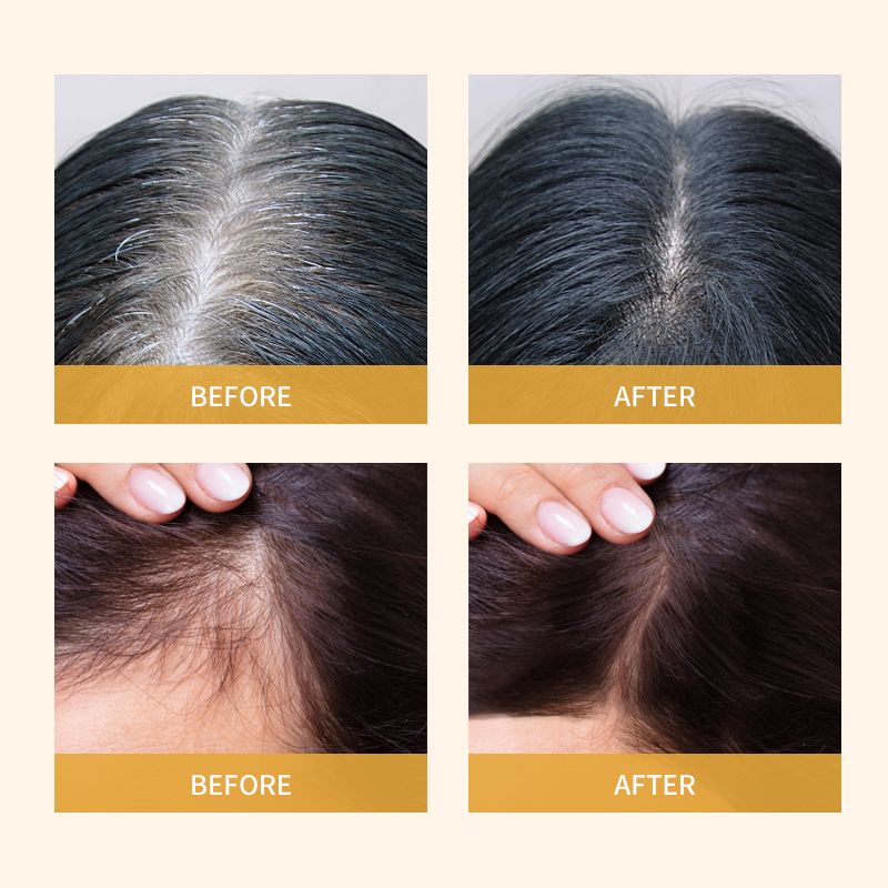 Serum Penumbuh Rambut Herbal dengan Biotin & Jahe