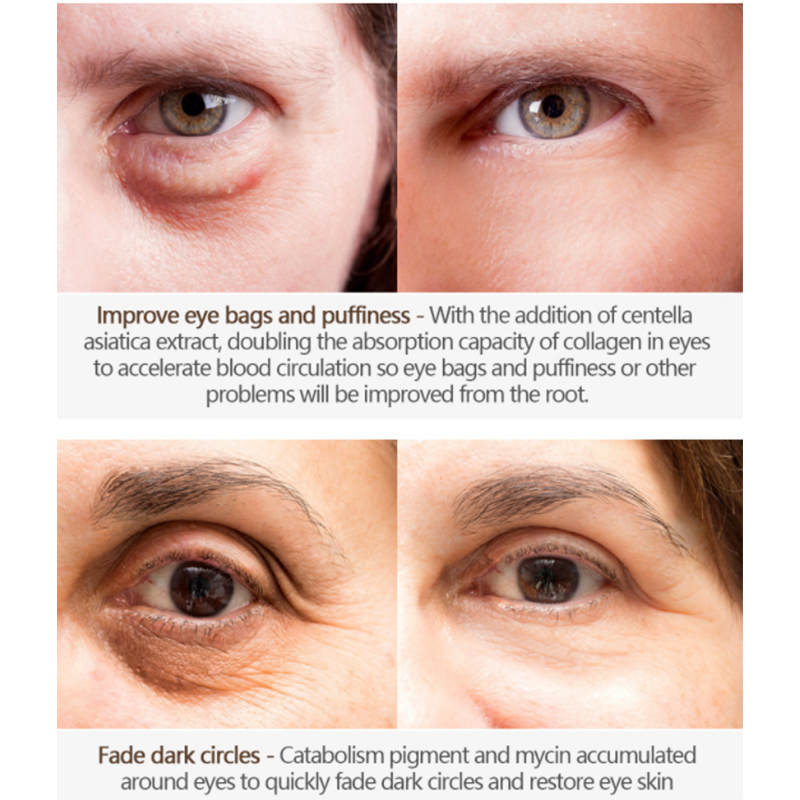 Krim Mata Anti Kerut Custom Dengan Aplikator (2) 