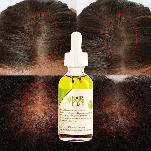 100% Minyak Perawatan Rambut Wanita Hitam Herbal Ayurveda Organik Alami